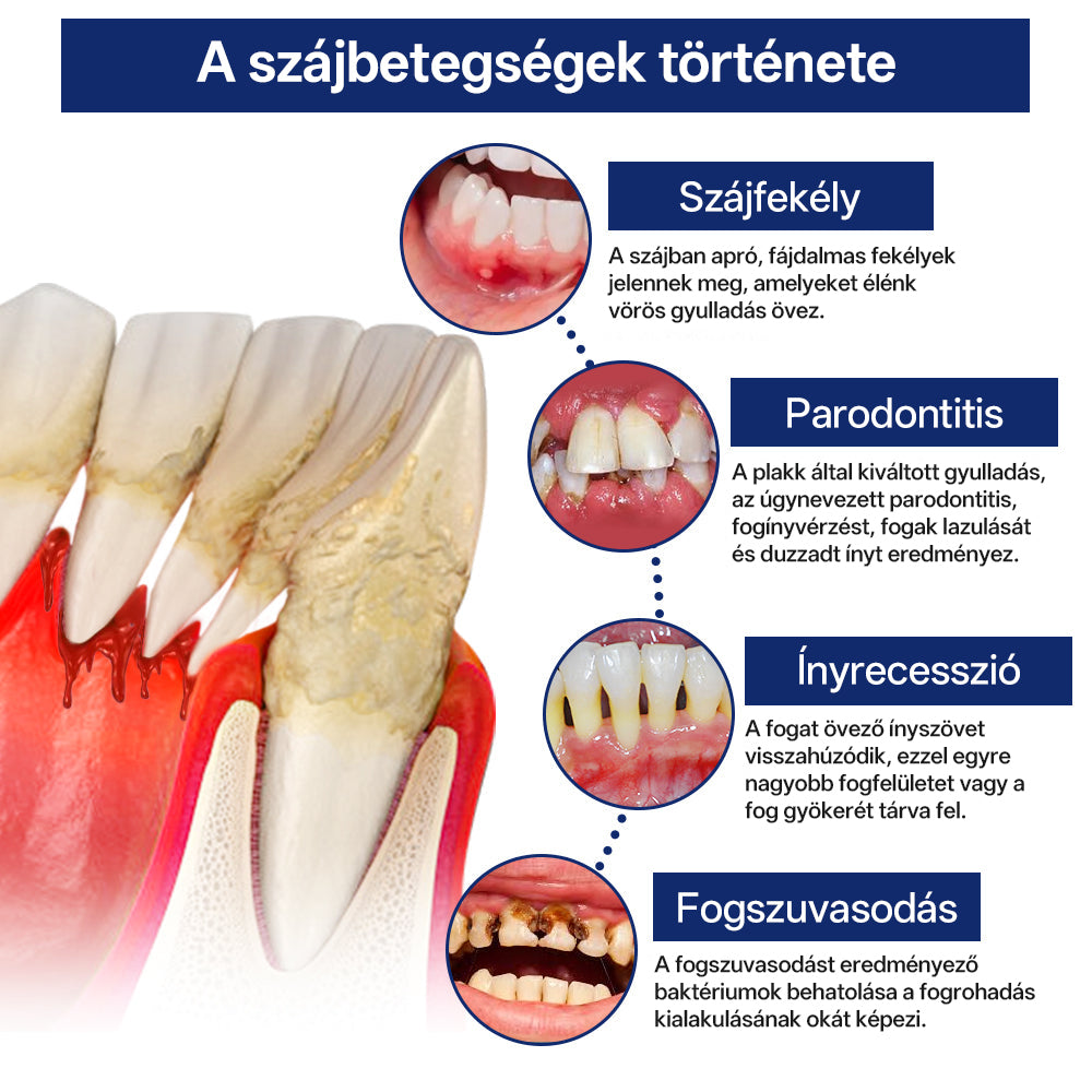 Rolimey® BeeTakt Méhméreg Fogápoló Cseppek Szájvíz-🛒