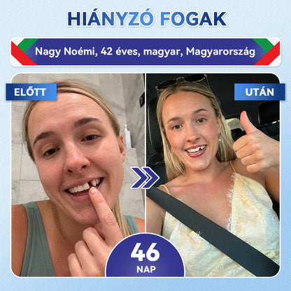🦷𝐆𝐥𝐢𝐦𝐦𝐞𝐫𝐥𝐲®😁  Tideglusib Fog & íny Javító mikrotűs tapasz | Fejlett őssejt-aktiváló fogcsíkok (újjáépíti a fogzománcot és a dentint • erősíti az ínyt • megszünteti a fogkövet és a szagokat • megállítja a fogérzékenységet)) 3.0-🌿