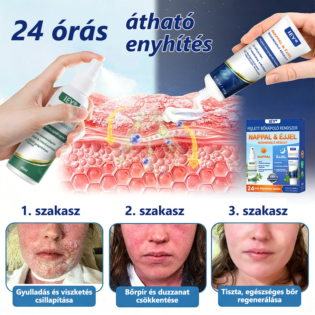 𝑰𝑬𝒀® 👩‍⚕️𝑷𝒔𝒐𝒓𝒊𝒂𝒔𝒊𝒔 𝒏𝒂𝒑𝒑𝒂𝒍𝒊 é𝒔 é𝒋𝒔𝒛𝒂𝒌𝒂𝒊 𝒉𝒆𝒍𝒚𝒓𝒆á𝒍𝒍í𝒕ó 𝒓𝒆𝒏𝒅𝒔𝒛𝒆𝒓 - 100% 𝒔𝒛𝒕𝒆𝒓𝒐𝒊𝒅𝒎𝒆𝒏𝒕𝒆𝒔 𝒅𝒖ó 𝒂 𝒑𝒍𝒂𝒌𝒌𝒐𝒌, 𝒉á𝒎𝒍á𝒔 é𝒔 𝒗𝒊𝒔𝒛𝒌𝒆𝒕é𝒔 𝒆𝒏𝒚𝒉í𝒕é𝒔é𝒓𝒆 (𝒂𝒋á𝒏𝒍𝒂𝒕)🛒🛒
