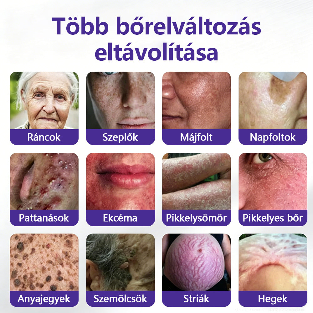 👩🏻‍⚕️COLTURE® szemölcs- és anyajegytávolító mikrotűs tapasz-🔥