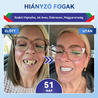 🦷𝐆𝐥𝐢𝐦𝐦𝐞𝐫𝐥𝐲®😁  Tideglusib Fog & íny Javító mikrotűs tapasz | Fejlett őssejt-aktiváló fogcsíkok (újjáépíti a fogzománcot és a dentint • erősíti az ínyt • megszünteti a fogkövet és a szagokat • megállítja a fogérzékenységet)) 3.0-🌿