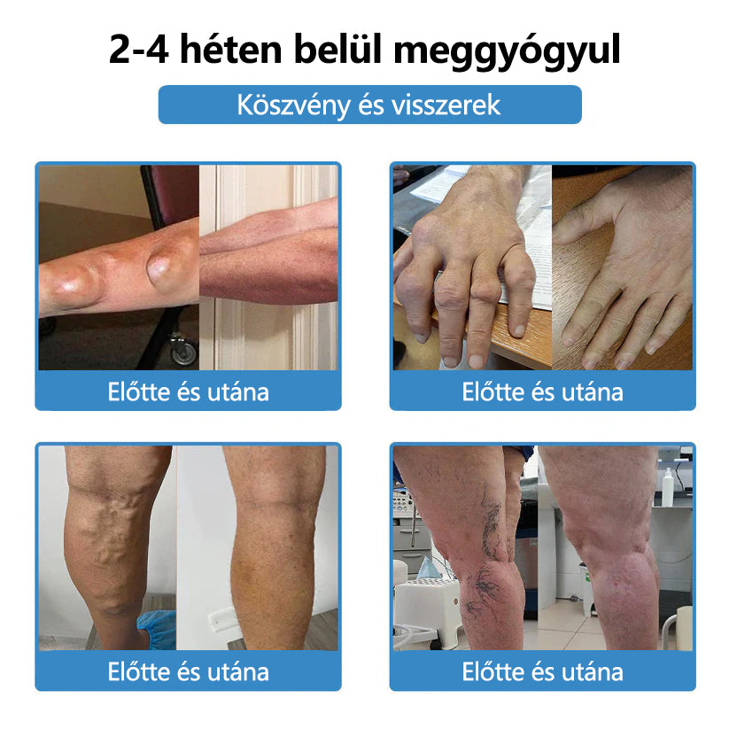 ClearaNature® Nano-tűs közös tapasz- 📦