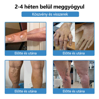 ClearaNature® Nano-tűs közös tapasz- 📦