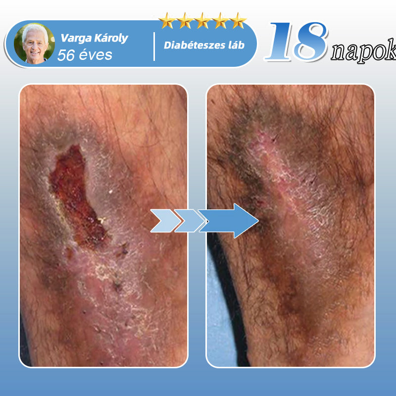 🇭🇺🛒✅𝐇𝐞𝐚𝐥𝐫𝐢𝐳𝐞® MoveFree Vital tapasz⚡Nyomelemek és gyógynövényes támogatás🌱Cukorbetegség, visszér, ízületi gyulladás, idegfájdalom-🌿