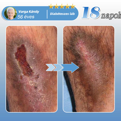 🇭🇺🛒✅𝐇𝐞𝐚𝐥𝐫𝐢𝐳𝐞® MoveFree Vital tapasz⚡Nyomelemek és gyógynövényes támogatás🌱Cukorbetegség, visszér, ízületi gyulladás, idegfájdalom-🌿