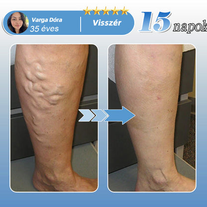 🇭🇺🛒✅𝐇𝐞𝐚𝐥𝐫𝐢𝐳𝐞® MoveFree Vital tapasz⚡Nyomelemek és gyógynövényes támogatás🌱Cukorbetegség, visszér, ízületi gyulladás, idegfájdalom-🌿