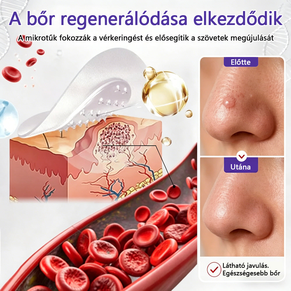 👩🏻‍⚕️COLTURE® szemölcs- és anyajegytávolító mikrotűs tapasz-🔥